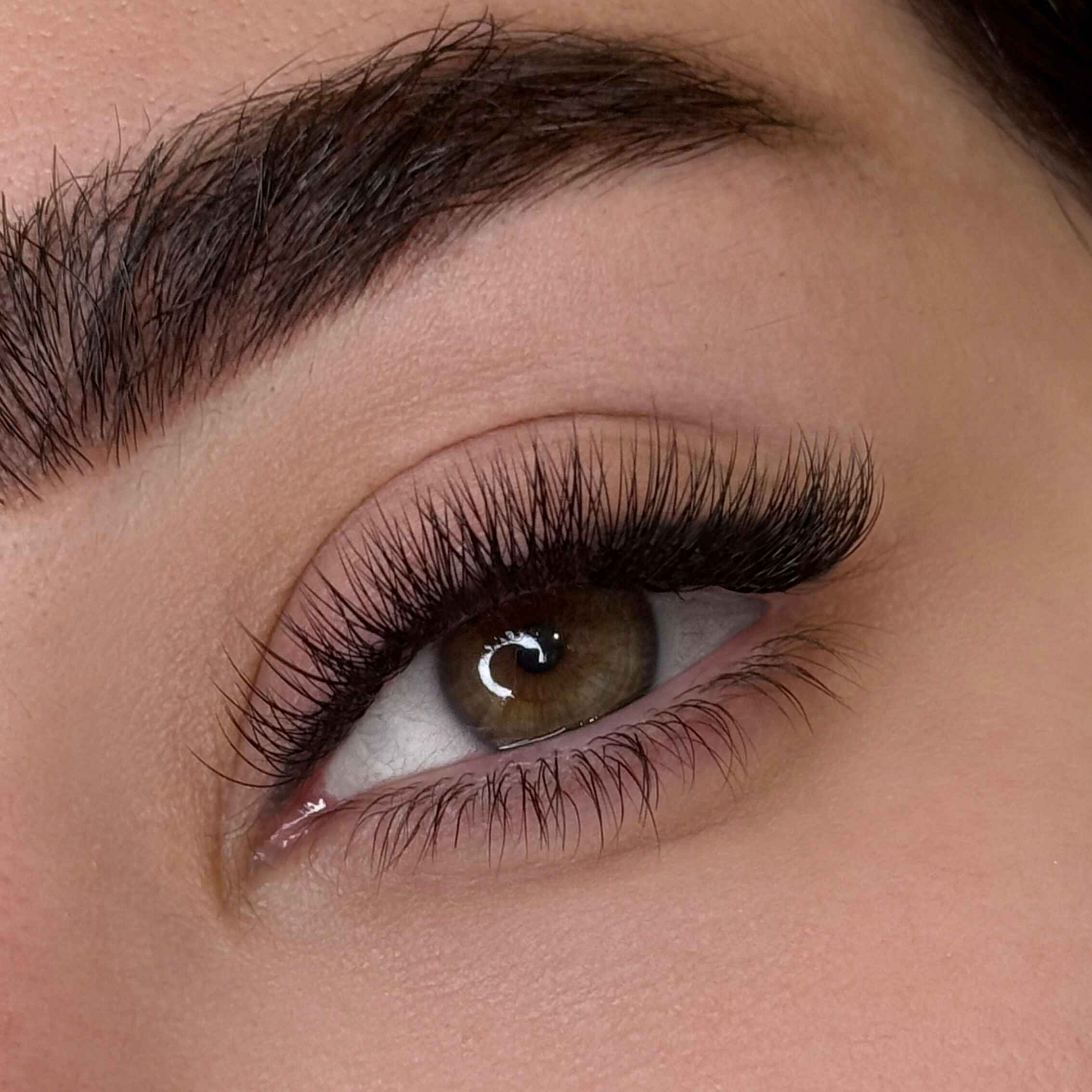 کاشت والیوم روسی 2D